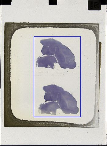 Media type: image; Special Collections 3043   shows specimen_part histological serial section;